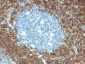  Bcl-2 (Apoptosis & Follicular Lymphoma Marker) Antibody - With BSA and Azide